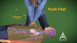 CPR cardiopulmonary resuscitation  3D animation [upl. by Sugna668]