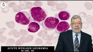 Acute Myeloid Leukemia 06 M3 [upl. by Onairotciv352]