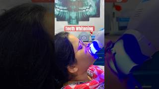 Teeth whitening Procedure 😱dentistaentiktok drrehanahmed dentistavenue l teethwhitening [upl. by Anilok]