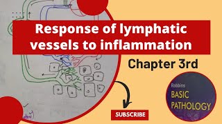 Responses of Lymphatic Vessels and Lymph Nodes to Inflammation LymphangitisLymphadenitisrobbins [upl. by Anila188]