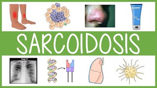 Sarcoidosis in 3 Minutes [upl. by Oicul]