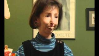 Scleroderma the Teresa Nadeau Story Part 1mp4 [upl. by Bores622]