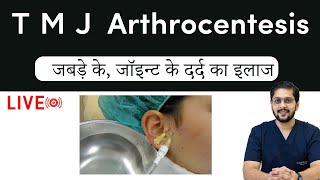 TMJ Arthrocentesis  Best treatment for joint pain  इंदौर मे जबड़े के जॉइन्ट के दर्द का इलाज [upl. by Naimaj]