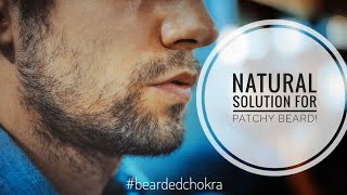 PATCHY BEARD  My First and Last Video [upl. by Ennaillij]