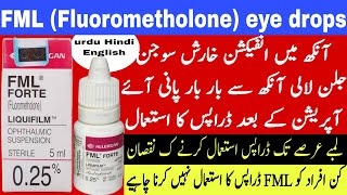 FML eye drops uses  fluorometholone eye drops  corticosteroids eye drops  eye infection treatment [upl. by Merralee]