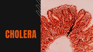 What is Cholera Causes Symptoms Transmission and Treatment [upl. by Ardnasella538]