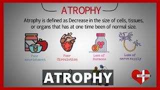 Atrophy Types and Causes Made Easy  What is atrophy [upl. by Johannessen]