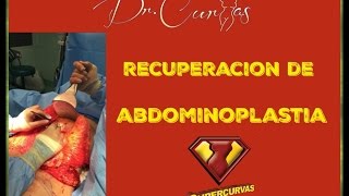 Recuperación de Abdominoplastia  Dr Cortes [upl. by Altman]