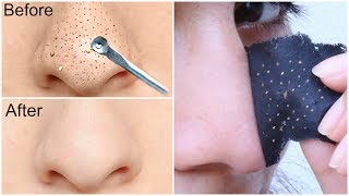 Easy DIY BLACKHEAD Remover Peel Off Mask  INSTANT RESULTS  Anaysa [upl. by Enier]