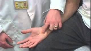 Ulnar Compression Test [upl. by Kobi]