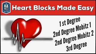 AV Heart Blocks Made Easy  1st 2nd 3rd Degree ECG Interpretation Explained [upl. by Raychel]