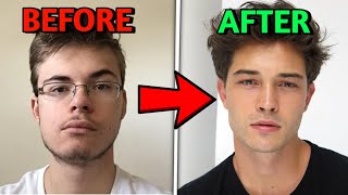 How to Fix Asymmetrical Jaw amp Face FOREVER [upl. by Chick]