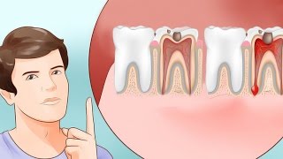 10 Quick amp Effective Home Remedies For Toothache Relief [upl. by Selimah]