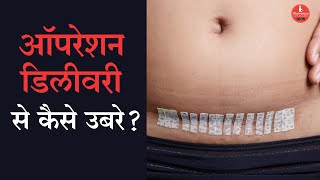 सिजेरियन डिलीवरी के बाद अपना ख्याल कैसे रखे Cesarean delivery recovery in Hindi [upl. by Randolf]