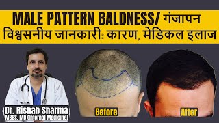 Causes Best Treatment Home Remedies In Hindi I Androgenic Alopecia I Male Pattern Baldness Cure [upl. by Ytteb]