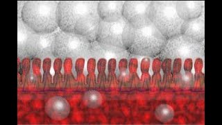 Necrotizing Enterocolitis NEC Part 2 Animation by Cal Shipley MD [upl. by Eceinart76]