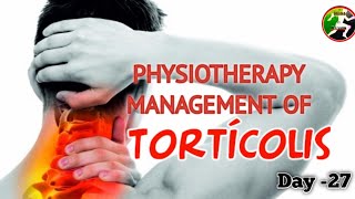 Day 27  Physiotherapy management of Torticolis Wry neck  Spasmodic torticolis [upl. by Aicilf]