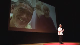 Implants  Giving People a Zest For Life  Hitoshi Tamaki  TEDxKatano [upl. by Johathan429]