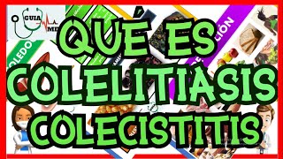 QUÉ ES COLELITIASIS Y COLECISTITIS  GuiaMed [upl. by Ekal278]