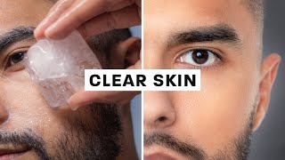 How To Get Clear Skin Science Based [upl. by Vito614]