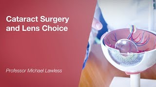 Cataract Surgery and Lens Choice [upl. by Frans218]