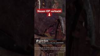 NasenOP verkackt 👃🏻💔  Schatten des Krieges [upl. by Elirpa741]