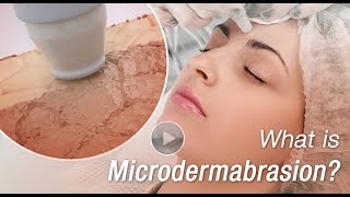 What is Microdermabrasion 3D Animation Video Explains [upl. by Pernas455]