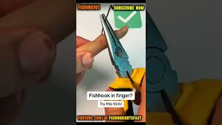 Safe Tips for Removing a Fishhook from Your Finger EasilyFishingSafety FishhookRemoval QuickTip [upl. by Palestine73]