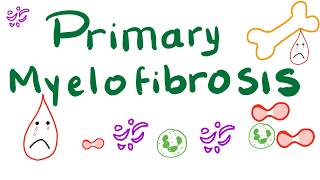 Primary Myelofibrosis PMF  Myeloproliferative Neoplasm Bone Marrow Fibrosis [upl. by Adnamas]