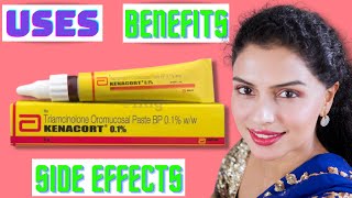 Kenacort 01 Gel  Kenacort Oral Paste Review  Abbott Kenacort  Kenacort Benefits and Side effects [upl. by Suolevram]