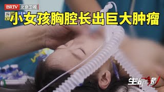 2024最新｜4岁女孩胸部肿瘤占据三分之二 心脏完全被挤压成纵条 手术中血压急剧降低 生死只在一线之间【生命缘第14季】 [upl. by Seif634]