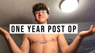 1 YEAR POST OP TOP SURGERY DR ADAM TOBIAS [upl. by Orpha]