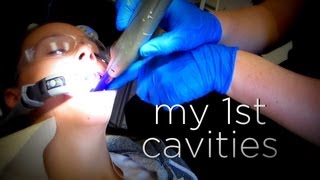 MY FIRST CAVITIES [upl. by Nido]