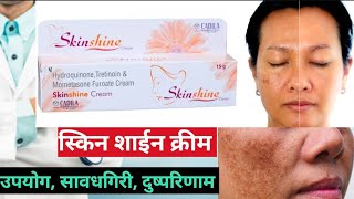 skinshine cream वापरण्याआधी ही माहिती असायलाच हवी l skinshine cream उपयोग सावधगिरी आणि दुष्परिणाम l [upl. by Atinyl]