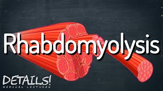 Rhabdomyolysis  Details [upl. by Goldia]