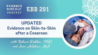 Evidence on Skin to Skin Care after a Cesarean [upl. by Elsie]