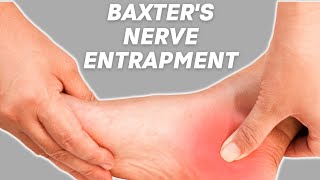 Baxters Nerve Entrapment COMPLETE OVERVIEW by Physical Therapists [upl. by Arvid404]