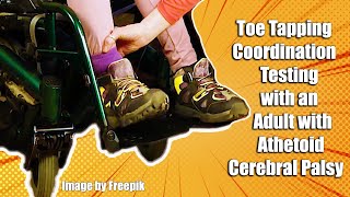 Toe Tapping Coordination Testing with an Adult with Athetoid Cerebral Palsy 7 [upl. by Wylie]