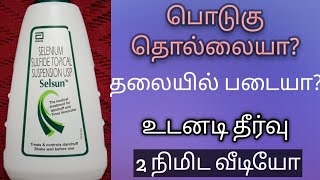 selsun anti dandruff shampoo review tamil  best anti dandruff shampoo  dandruff permanent solution [upl. by Iy380]