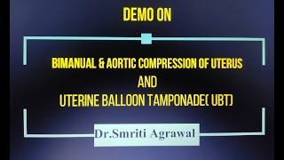 Bimanual amp Aortic Compression of Uterus amp UBT by AddProfDr Smriti Agarwal KGMULucknow [upl. by Hiroshi]