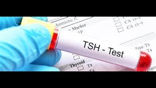 What is T3 T4 TSH What is Hypothyroidism  Hyperthyroidism Full Details of Thyroid Problem Test [upl. by Tanya]