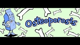 Osteoporosis of the Skull 🤕 [upl. by Aihsined]