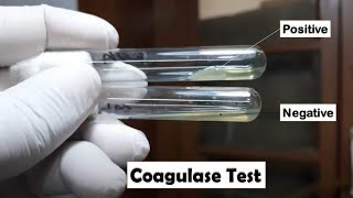 Tube Coagulase Test Positive and Negative for Staphylococcus aureus and CoNS Identification [upl. by Imis]