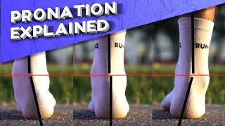 What is overpronation  Pronation types explained [upl. by Ydak966]