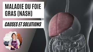 NASH  stéatose hépatique foie gras  causes et solutions [upl. by Enetsirhc]