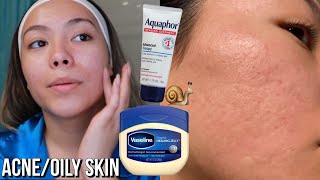 Viral Skincare Slugging using Vaseline and Aquaphor [upl. by Wendye393]