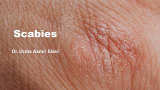 WHAT IS SCABIES  MBBS REVISION GUIDE  2024 SHORT GUIDE [upl. by Cyprio584]