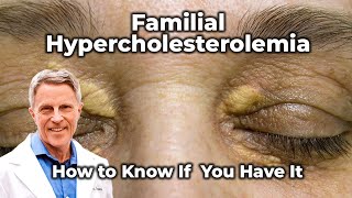 Familial Hypercholesterolemia  How to Know If You Have It [upl. by Romalda157]