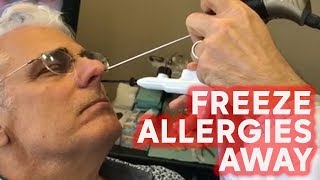 Freeze your allergies away with this treatment [upl. by Eirehc212]