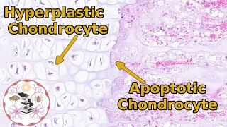 Epiphyseal Growth Plate Histology  Time to Zone Out [upl. by Humfried608]